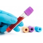 Отзывы о ЭПР ТСА тест