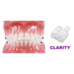 Отзывы о Брекеты Clarity Advanced Flash Free