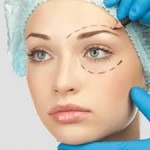 Отзывы о Блефаропластика